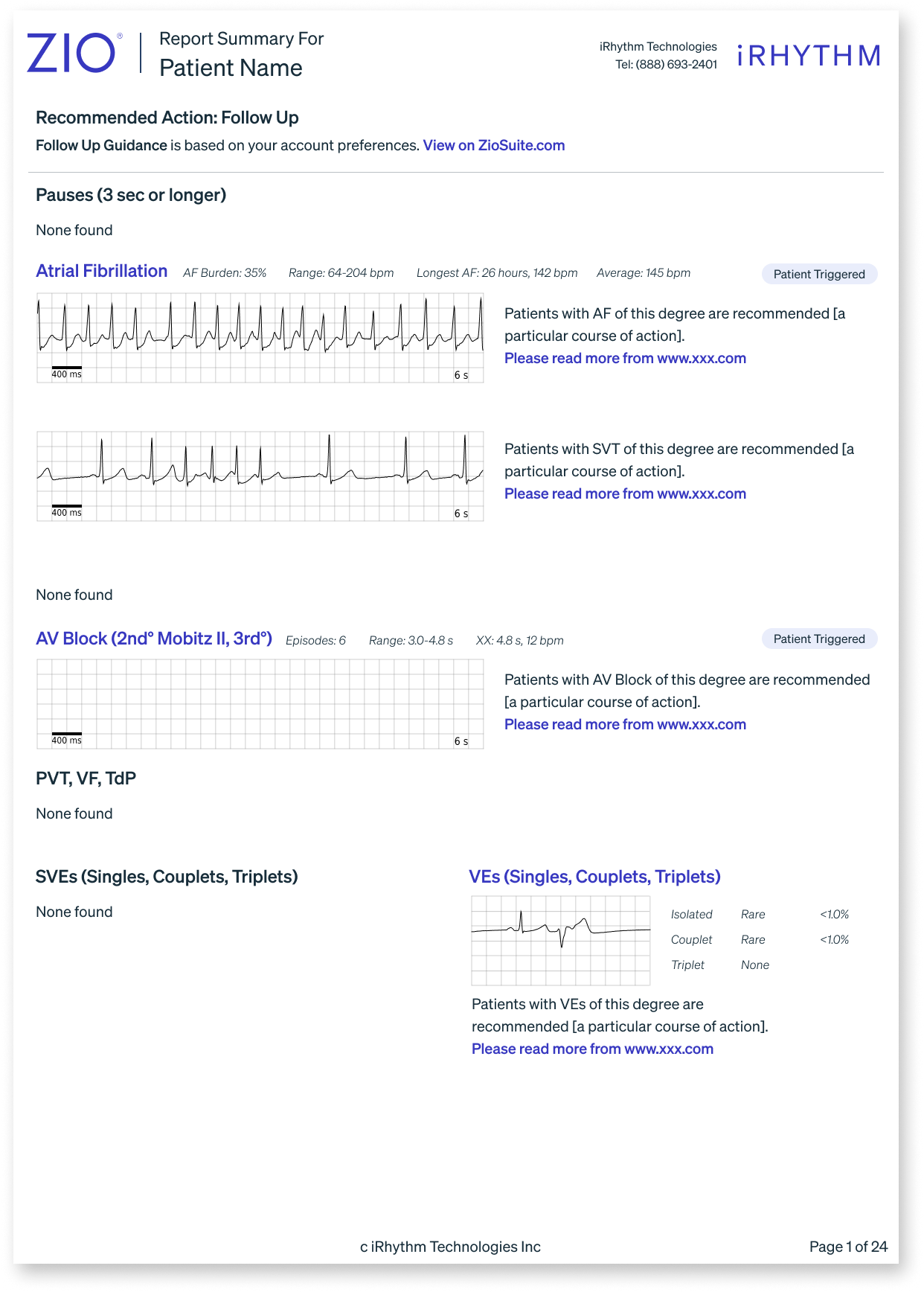 Early iteration — data-heavy visualization